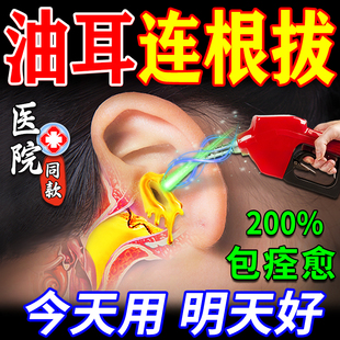 油耳朵清洁器儿童油耳朵治疗去油神器清理耳痒油耳克星专用滴耳液