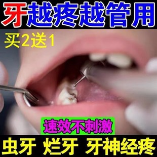 牙痛专用药水止疼药速效宁喷雾治牙龈肿痛牙神经上火蛀牙智齿 推荐